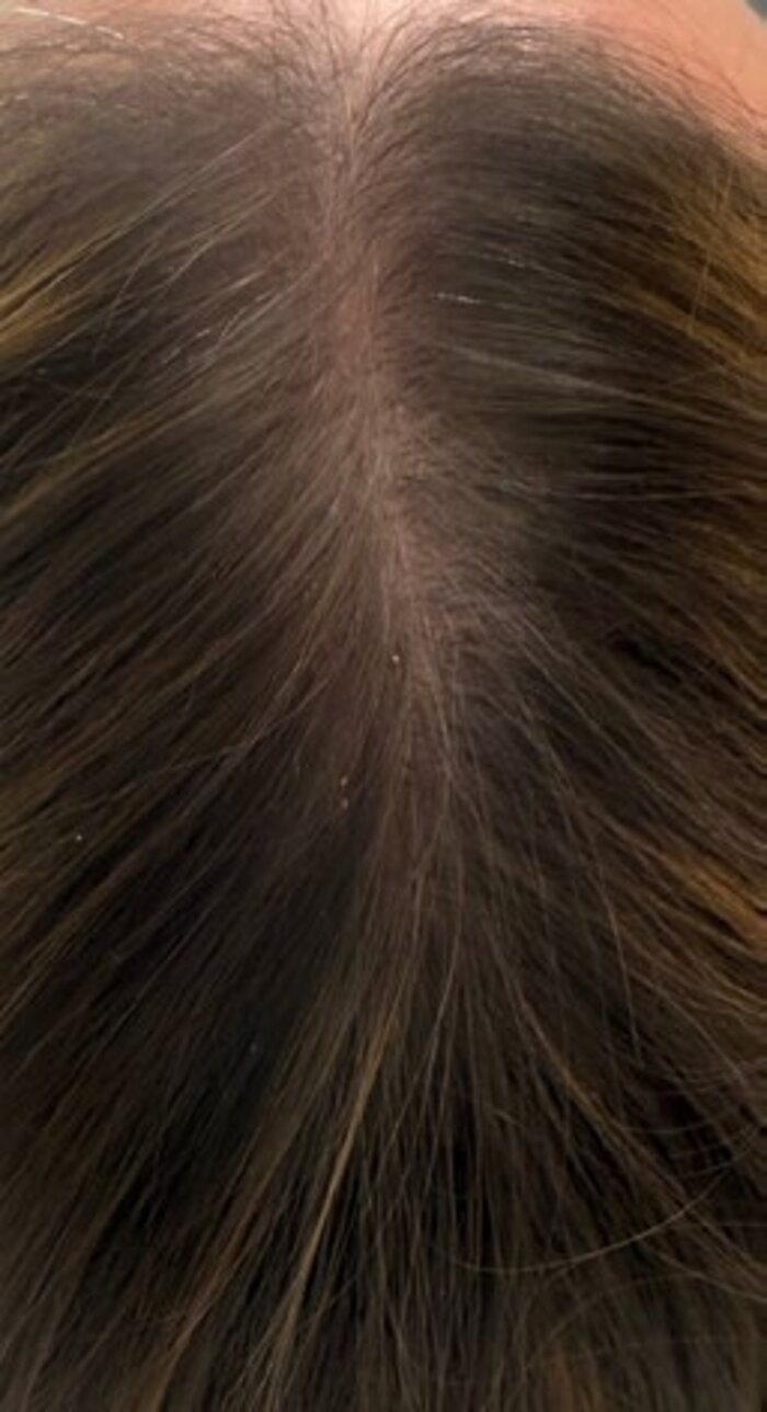 Crown and parting after treatment